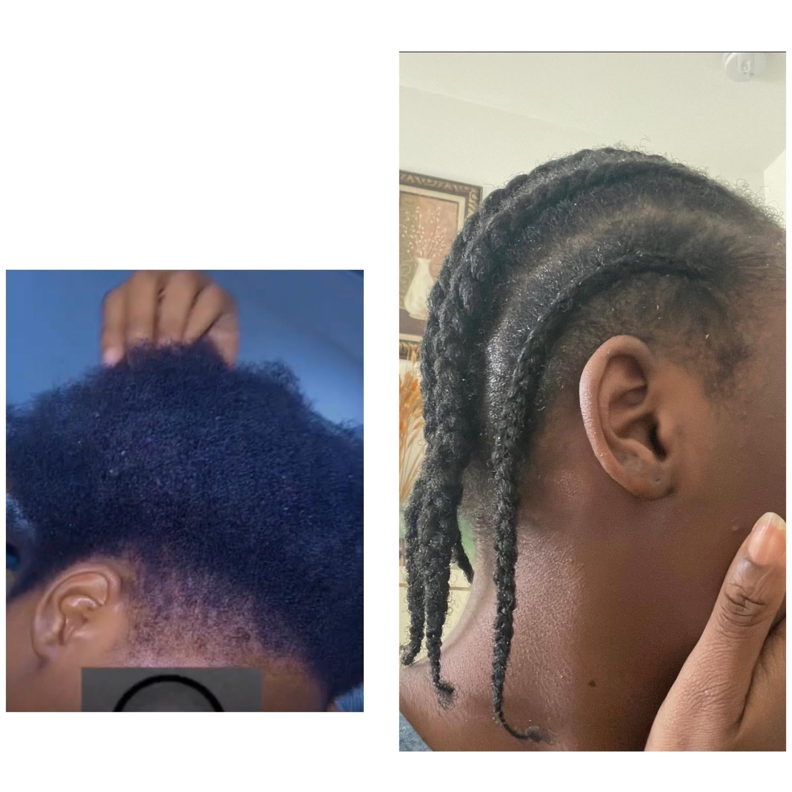 FABIBIE hair growth big size Gamme complet 6 products :shampoo,conditioner,oil,pomade sérum spray,hair mask