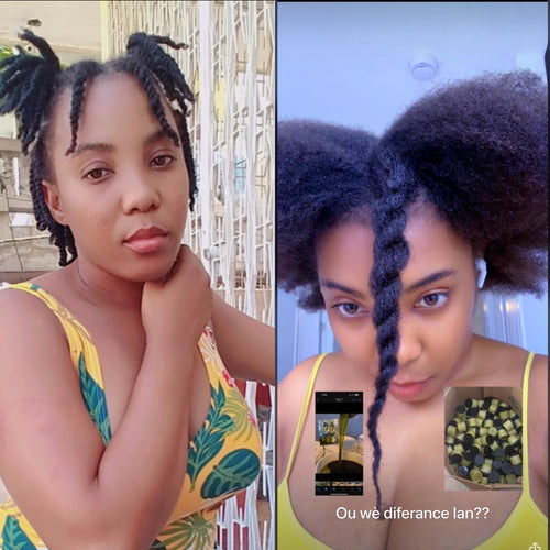 FABIBIE hair growth scalp oil 5oz made with 35 powerful naturals ingredients, Herbs & powder organic